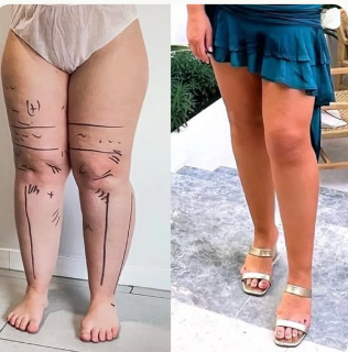 Sophie, 44 ans